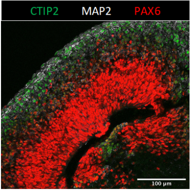 Fig.1 iPSC-derived cerebral organoid.