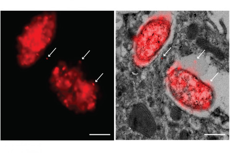 Super-resolution CLEM Imaging Of Salmonella-host Interactions - Cell ...