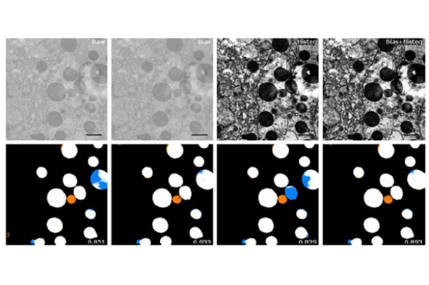 Standardization of Electron Microscopy Data for Artificial Intelligence ...