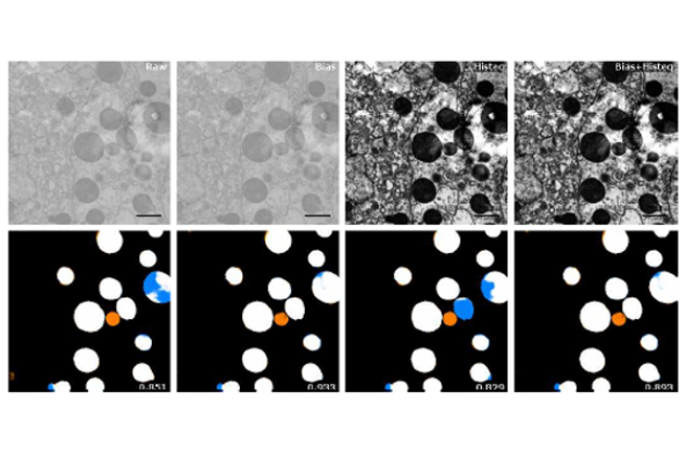 Standardization of Electron Microscopy Data for Artificial Intelligence