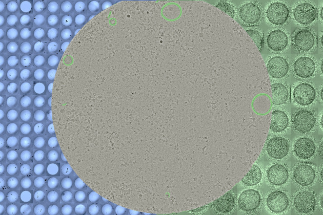 Characterization of Extracellular Vesicles and Co-Isolating Particles Using Cryo-Electron Microscopy and Artificial Intelligence