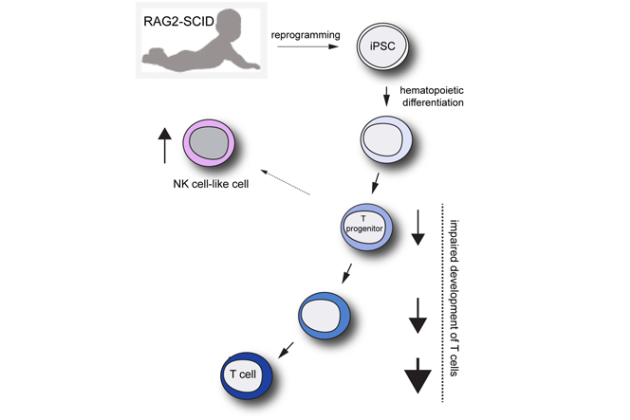 Modelling human RAG2-SCID using iPSC