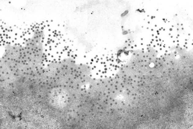 Electron Microscopy of Corona Virus in Volkskrant