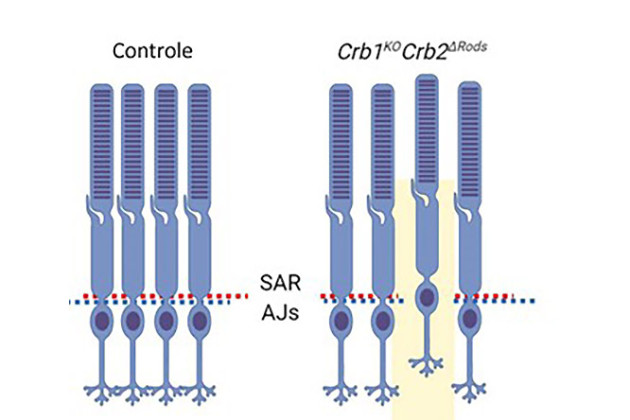 CRB2 Loss in Rod Photoreceptors
