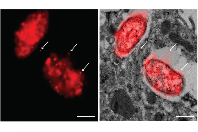 Super-resolution CLEM imaging of Salmonella-host interactions